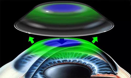 近視,小兒眼病,希瑪瑞視眼科,上海眼科醫院 近視,小兒眼病,希瑪瑞視眼科,上海眼科醫院