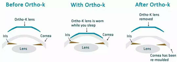 小兒眼病,希瑪瑞視眼科,上海眼科醫院 小兒眼病,希瑪瑞視眼科,上海眼科醫院