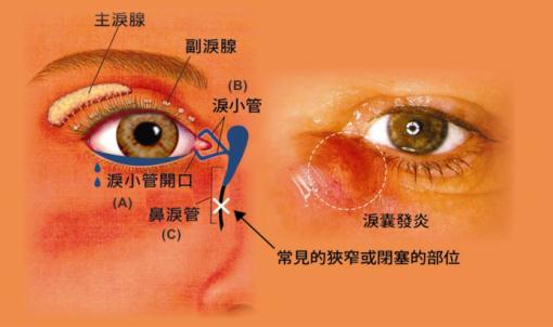 眼眶病,?，斎鹨曆劭?上海眼科醫院