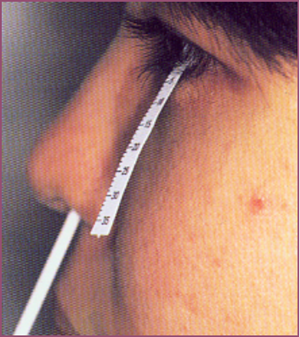 眼表眼角膜,希瑪瑞視眼科,上海眼科醫院