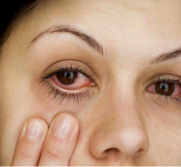 眼表眼角膜,?，斎鹨曆劭?上海眼科醫院