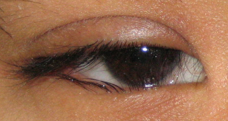 眼眶病,?，斎鹨曆劭?上海眼科醫院