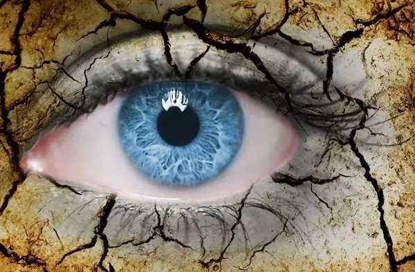 眼表眼角膜,希瑪瑞視眼科,上海眼科醫院