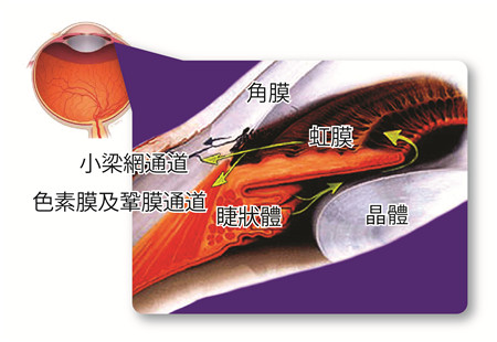 青光眼,希瑪瑞視眼科,上海眼科醫(yī)院 青光眼,希瑪瑞視眼科,上海眼科醫(yī)院