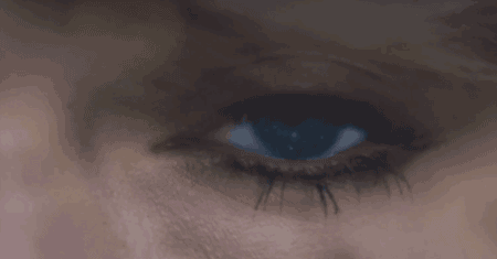 青光眼,希瑪瑞視眼科,上海眼科醫(yī)院 青光眼,希瑪瑞視眼科,上海眼科醫(yī)院