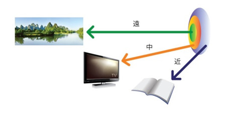 白內障,希瑪瑞視眼科,上海眼科醫院 白內障,希瑪瑞視眼科,上海眼科醫院