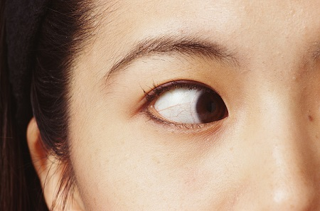 小兒眼病,希瑪瑞視眼科,上海眼科醫(yī)院 小兒眼病,希瑪瑞視眼科,上海眼科醫(yī)院