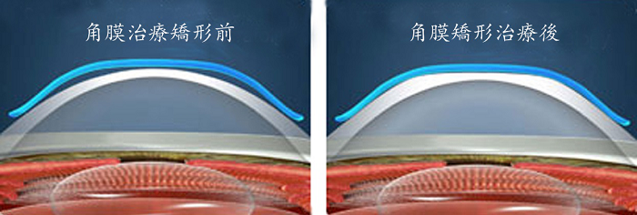 小兒眼病,希瑪瑞視眼科,上海眼科醫院 小兒眼病,希瑪瑞視眼科,上海眼科醫院