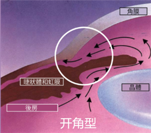 青光眼,希瑪瑞視眼科,上海眼科醫(yī)院 青光眼,希瑪瑞視眼科,上海眼科醫(yī)院