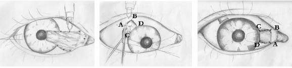 眼表眼角膜,希瑪瑞視眼科,上海眼科醫(yī)院