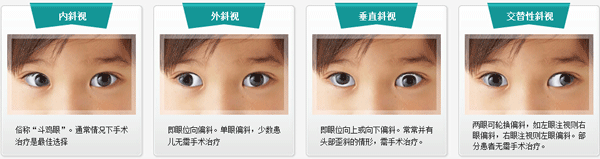 小兒眼病