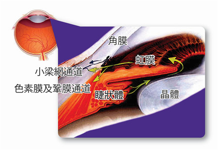 青光眼,希瑪瑞視眼科,上海眼科醫院 青光眼,希瑪瑞視眼科,上海眼科醫院