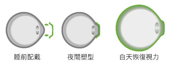 小兒眼病,希瑪瑞視眼科,上海眼科醫(yī)院 小兒眼病,希瑪瑞視眼科,上海眼科醫(yī)院