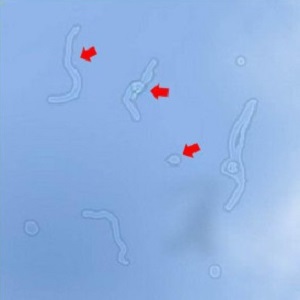 玻璃體視網膜,希瑪瑞視眼科,上海眼科醫院 玻璃體視網膜,希瑪瑞視眼科,上海眼科醫院