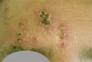 眼表眼角膜,希瑪瑞視眼科,上海眼科醫院