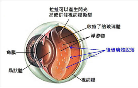 玻璃體視網(wǎng)膜