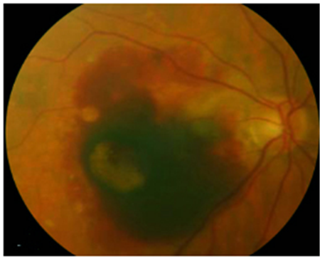 眼表眼角膜,?，斎鹨曆劭?上海眼科醫(yī)院