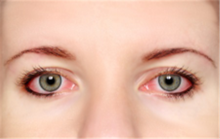 眼表眼角膜,希瑪瑞視眼科,上海眼科醫(yī)院 眼表眼角膜,希瑪瑞視眼科,上海眼科醫(yī)院