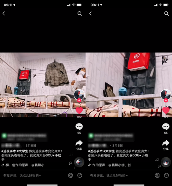 屈光矯視,希瑪瑞視眼科,上海眼科醫院