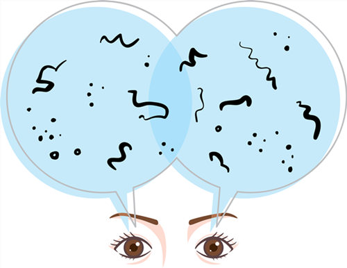 玻璃體視網(wǎng)膜,希瑪瑞視眼科,上海眼科醫(yī)院 玻璃體視網(wǎng)膜,希瑪瑞視眼科,上海眼科醫(yī)院