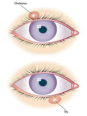 眼表眼角膜,希瑪瑞視眼科,上海眼科醫(yī)院